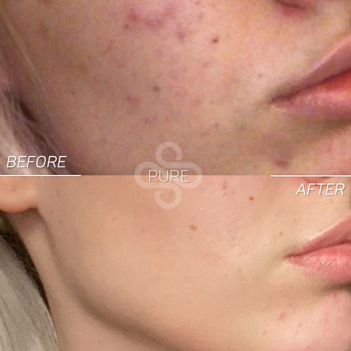 Purifying Mask Alissa Beauté 100 ml