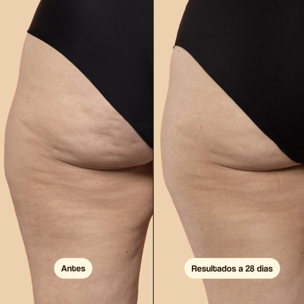 Creme anticelulite e reductor 100ml - Freshly Cosmetics