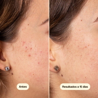 Azelaic Radiance Face  Serum 50ml -Freshly